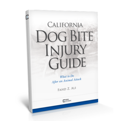California Dog Bite Guide